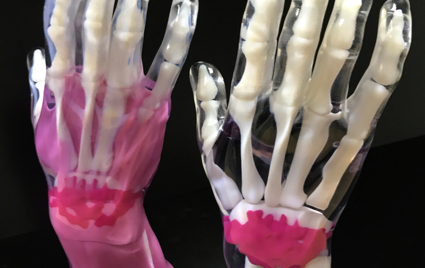 Multi material Polyjet anatomical model